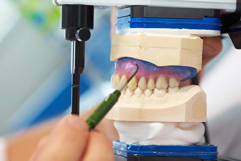 Endodontics Gatineau