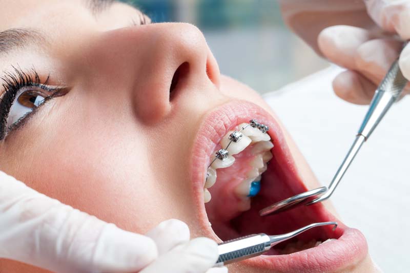 Orthodontist Gatineau