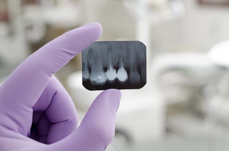 Radiographs Ottawa
