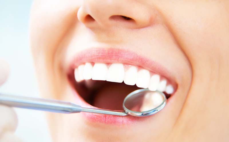Dental Examination Gatineau